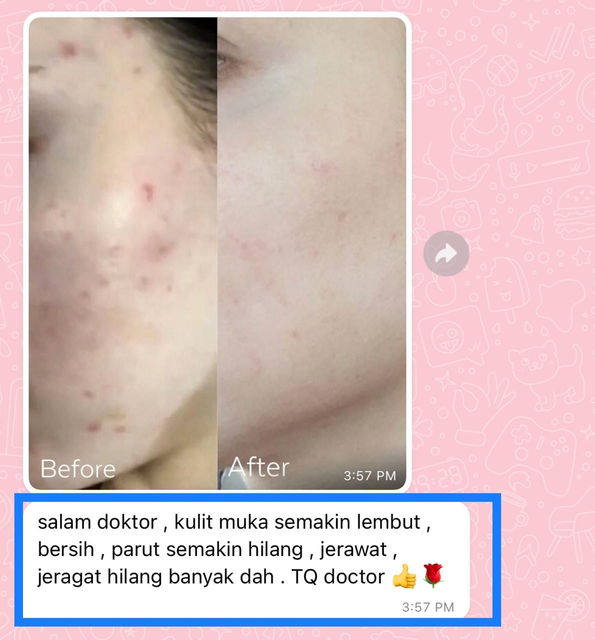Testimoni